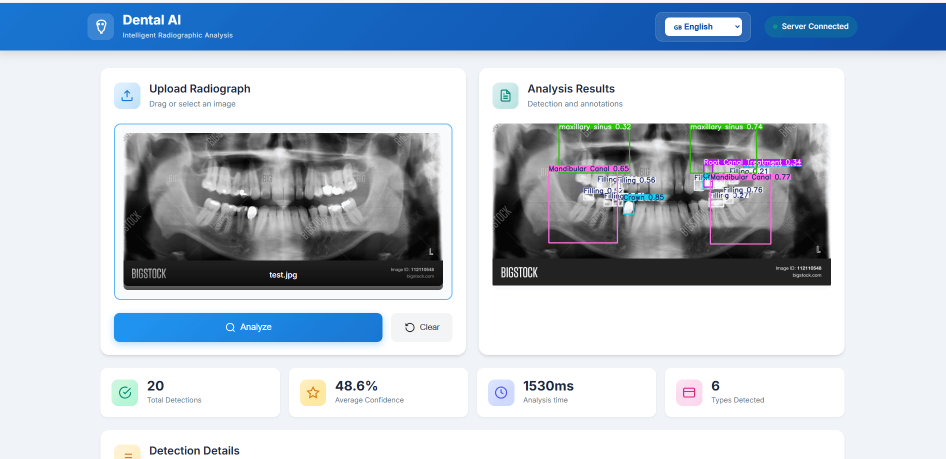 Dental diagnosis web app & ML model