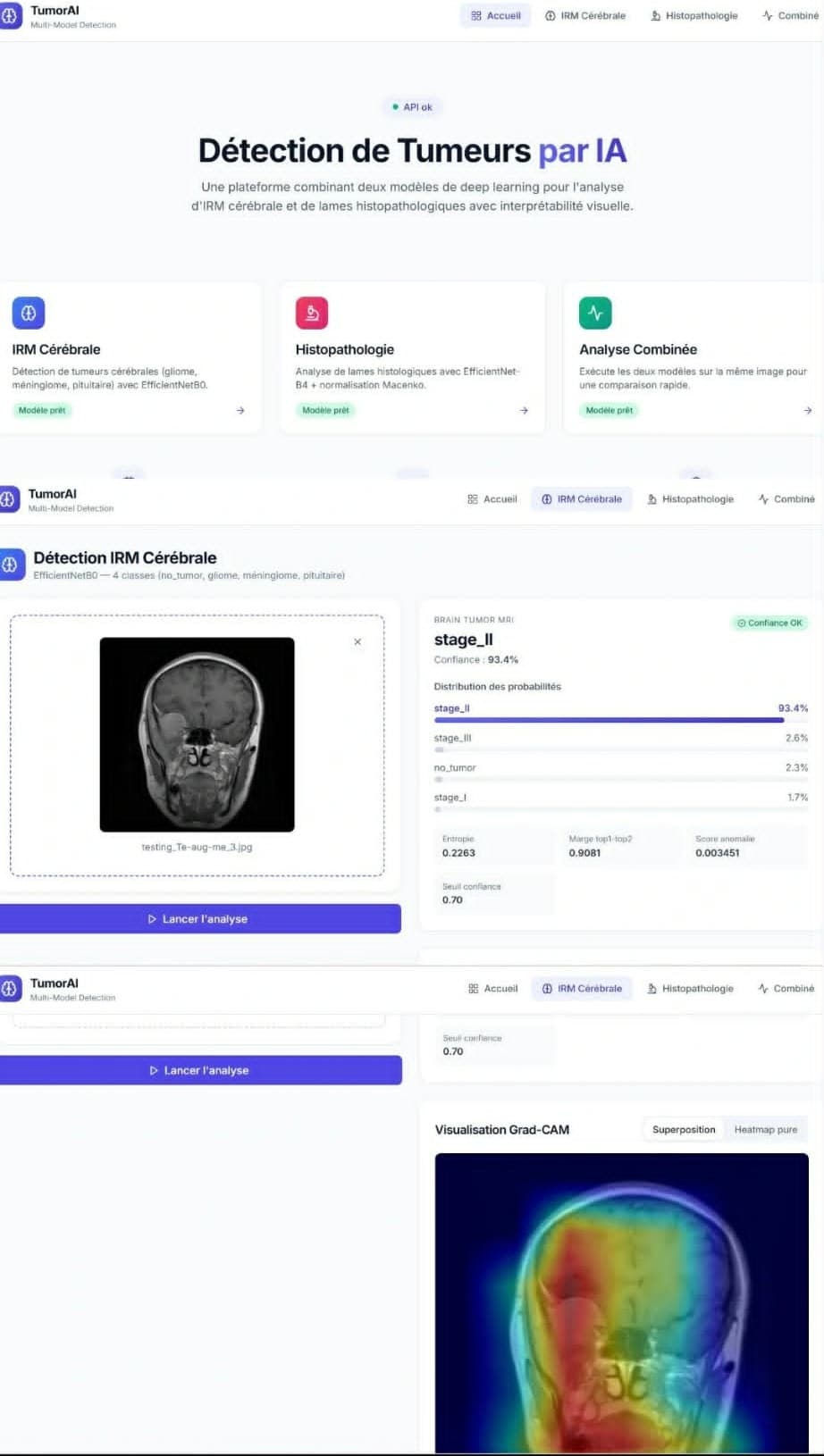 Brain Tumor Detection — Web App & ML Pipeline
